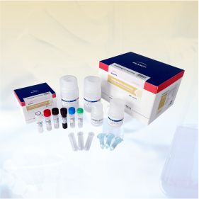 非洲豬瘟病毒熒光PCR檢測(cè)試劑盒